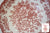 Vintage English Red Toile Pink Transferware Cereal / Salad Bowl Cabbage Roses Daisies